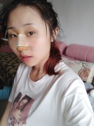 点击看大图 体验后-鑫元辰医疗美容整形