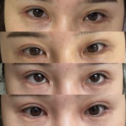 体验后-成都艾特他整形外科医院