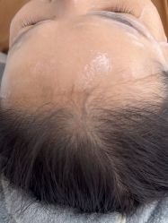 -长沙雅美医疗美容医院