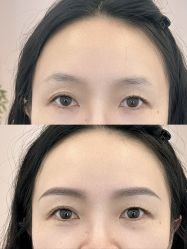 点击看大图 -杨益美学·野生眉半永久纹眉发际线