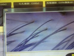 完成养护后检测-菩叶头皮抗衰养发护发