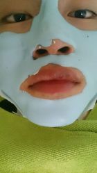 -苗方清颜·祛痘皮肤管理