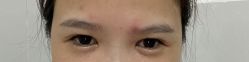 点击看大图 -广州美莱医疗美容医院