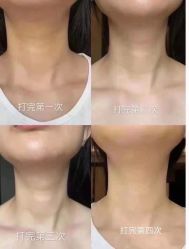 -上海漾颜医疗美容