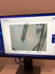 -大麦微针植发丨全国连锁