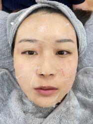 体验后-禾美嘉医疗美容