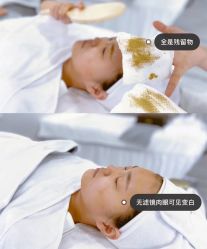 -美肤盾祛痘·问题肌头疗管理中心