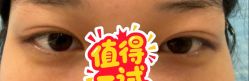 -长沙雅美医疗美容医院