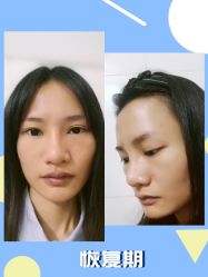 -广东韩妃整形外科医院