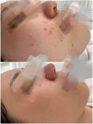 -康美贞·痘肌养护管理中心