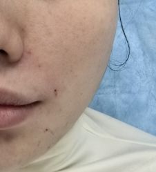 -长沙雅美医疗美容医院
