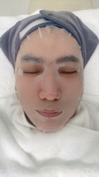 -安那般那皮肤年轻化ANAPANA