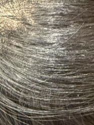 -碧莲盛·不剃发植发