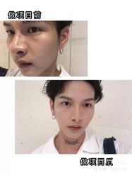 -美壹生诊所皮肤管理中心·海菲秀&Legacy美白舱