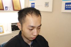 -大麦微针植发丨全国连锁