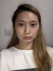 -成都西区医院整形美容