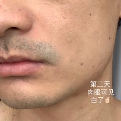 点击看大图 体验后-纯粹医美