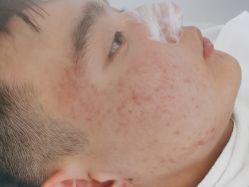 -蕾特恩专业祛痘·皮肤管理