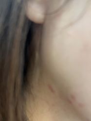 -美瑞莎创美医疗美容