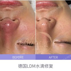 -Boss H Beauty美肌中心