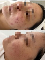 -康美贞·痘肌养护管理中心