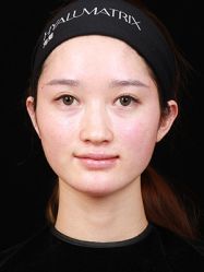 体验后-Yestar 嘉兴艺星医疗美容医院