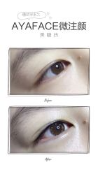 点击看大图 -AYA FACE 微注颜·德式半永久定妆