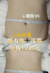 -Lily纤美·科技减脂中心