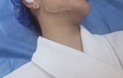 -四川米兰柏羽医学美容医院