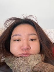 体验前-澳尔颜选医疗美容