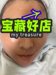 体验后-联合丽格·张菡丽格医疗美容