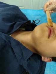 -成都西区医院整形美容