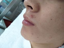 -痘博士北京·全国连锁祛痘机构