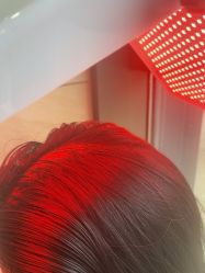 -碧莲盛·不剃发植发