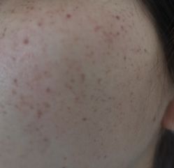 体验后-武汉颜范薇美医疗美容门诊部