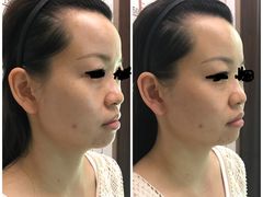 -修申骨雕小颜脊柱骨盆管理产后修复