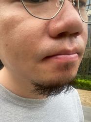 -ROYEA茹彦祛痘·问题肌肤修护中心