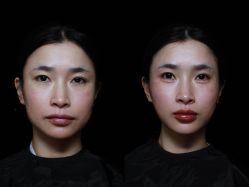 点击看大图 -Yestar艺星整形美容医院