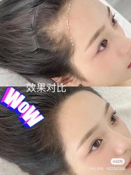 -德绣·机器野生眉发际线·美瞳线半永久