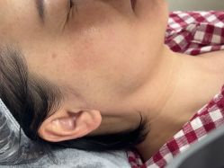-长沙雅美医疗美容医院
