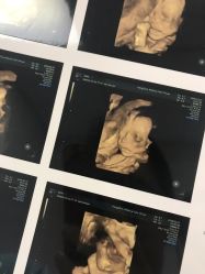 -杭州贝瑞斯美华妇儿医院·早孕·产检·儿科