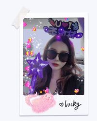 体验后-大麦微针植发全国连锁