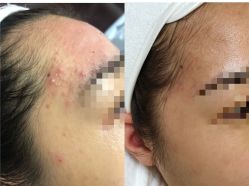 -康美贞·痘肌养护管理中心