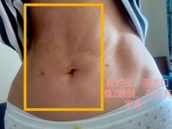 体验后-美莱医疗美容医院