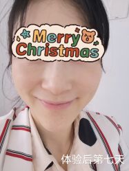 -天津健丽·去眼袋医疗美容机构