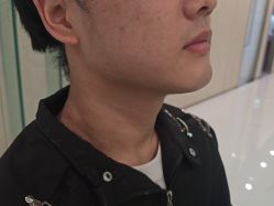 点击看大图 -Yestar艺星整形美容医院
