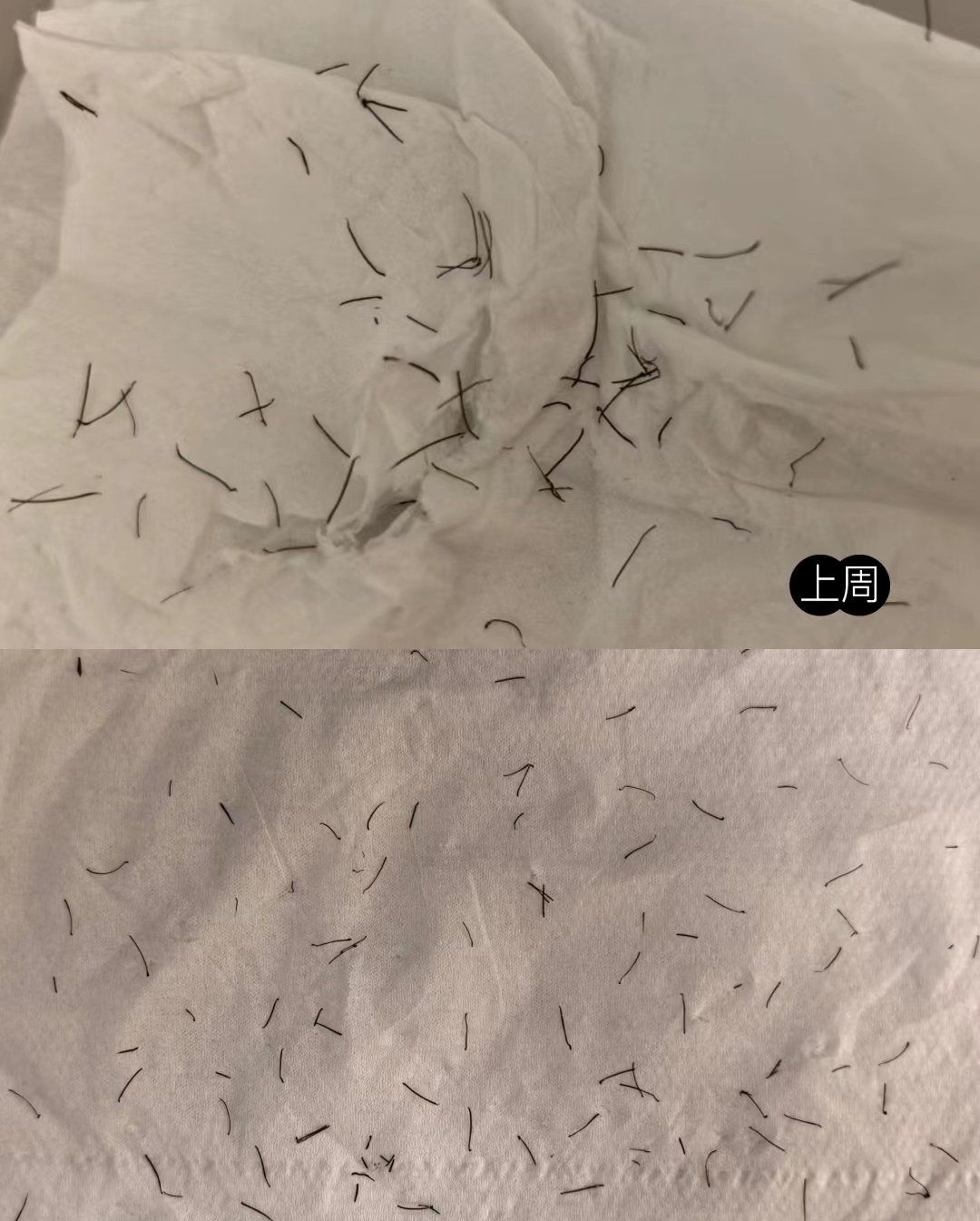 比基尼 毛发开始脱落了