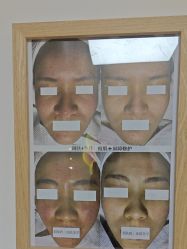 -美肤盾祛痘·问题肌头疗管理中心