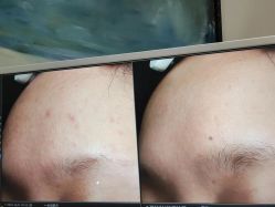 -苑苑vbeauty科技美容SPA