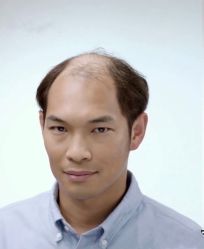 -发饰美男士增发补发假发定制店